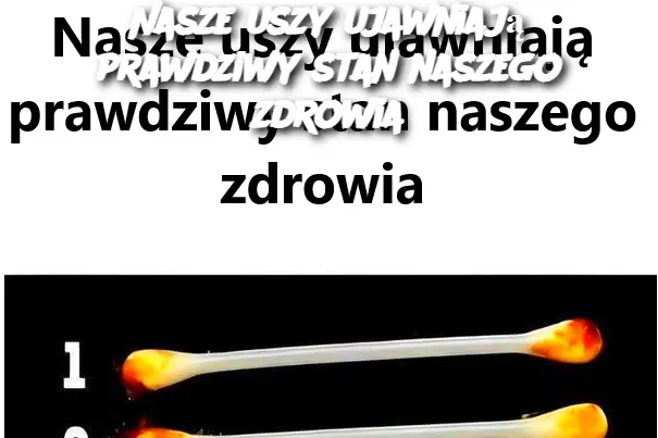 Nasze uszy ujawniają prawdziwy stan naszego zdrowia