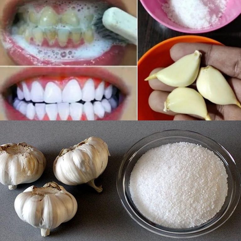 Domowe wybielanie zębów w 2 minuty Jak naturalnie wybielić żółte zęby 100% skuteczne