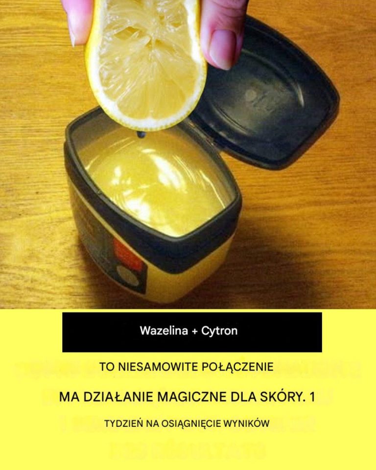 Przepis na bazie wazeliny i cytryny dla skóry