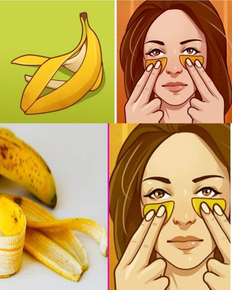 Nie wyrzucaj skórek od bananów. Oto 7 niezbędnych zastosowań. Artykuł znajduje się w pierwszym komentarzu