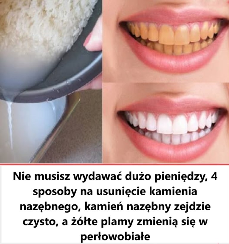 Nie marnuj więcej pieniędzy na dentystę
