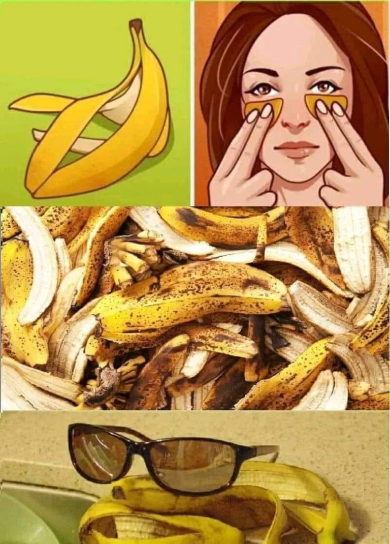Nie wyrzucaj skórek od bananów – oto 7 niezbędnych zastosowań