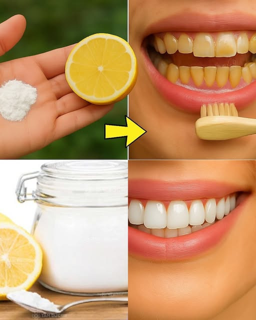 Odkryj sekret olśniewającego uśmiechu dzięki citronowi i soda oczyszczonej — naturalne sposoby na biały i zdrowy uśmiech