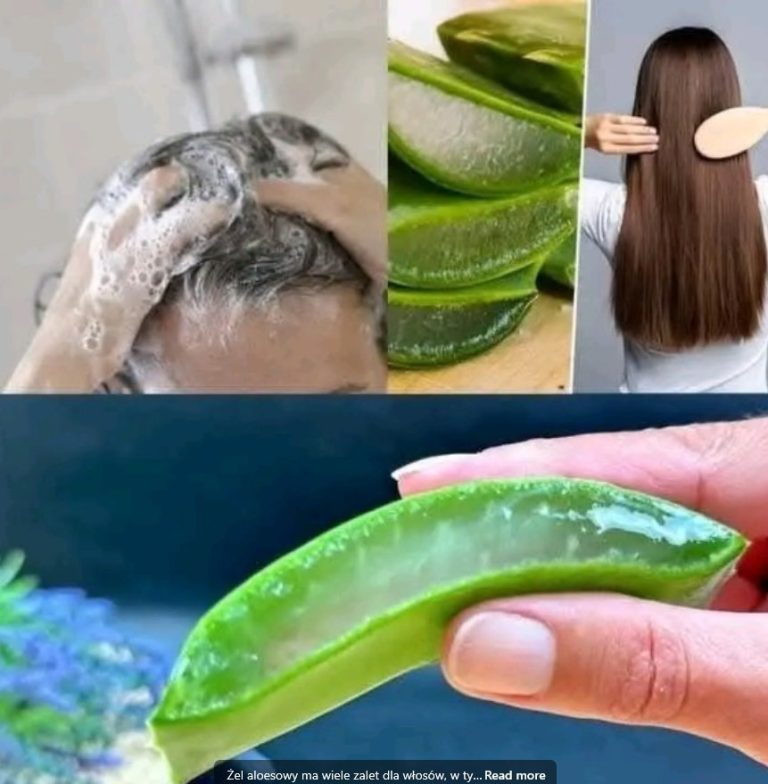 Żel aloesowy to naturalny produkt, który ma wiele korzyści dla zdrowia włosów. Oto kilka z nich: