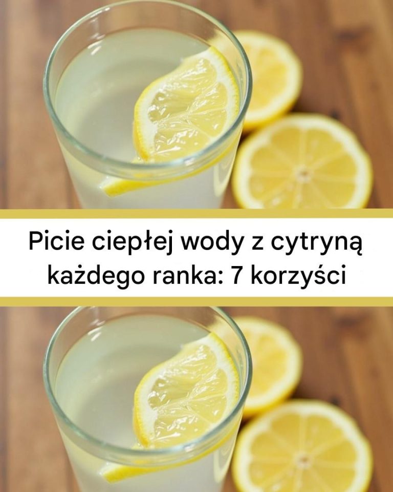 Picie ciepłej wody z cytryną każdego ranka: 7 korzyści, które zmienią Tw  Edit with Elementoroją rutynę