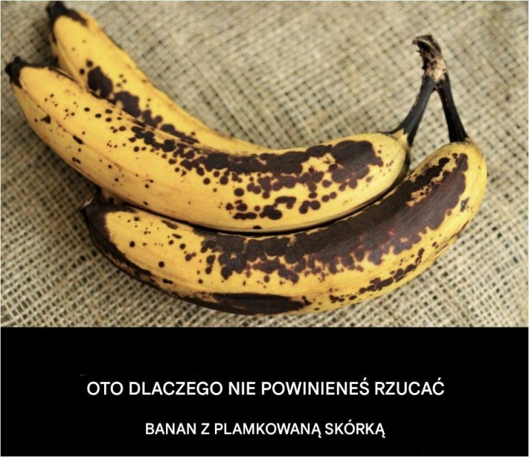 Oto dlaczego nie należy wyrzucać banana z plamistą skórką