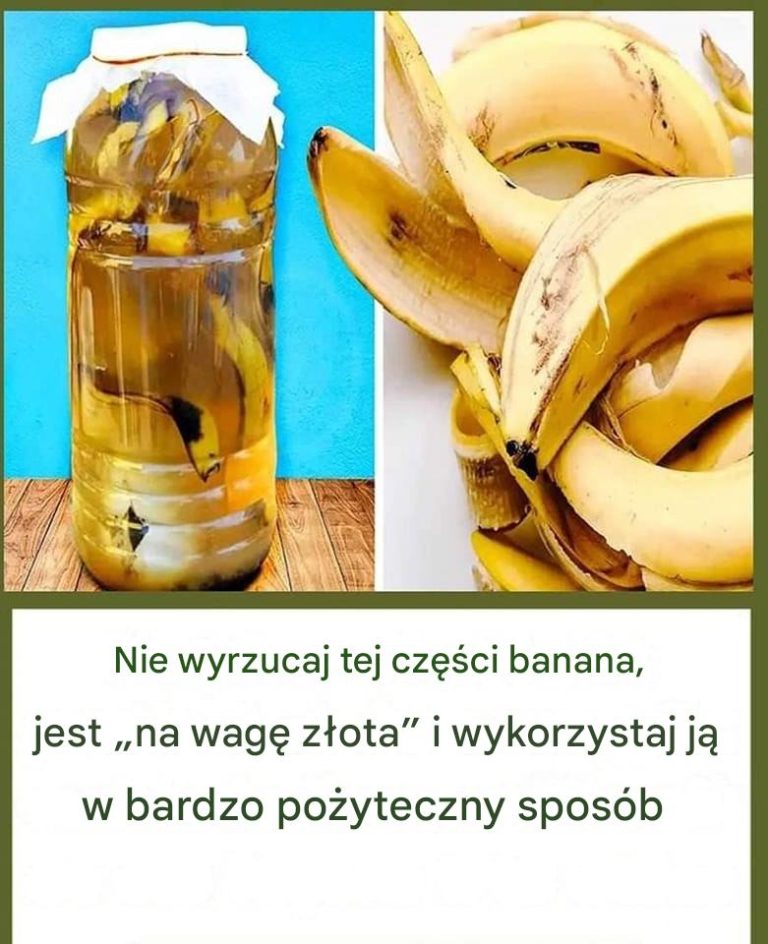 12 rzeczy, które możesz zrobić ze skórkami od banana, zamiast je wyrzucać!