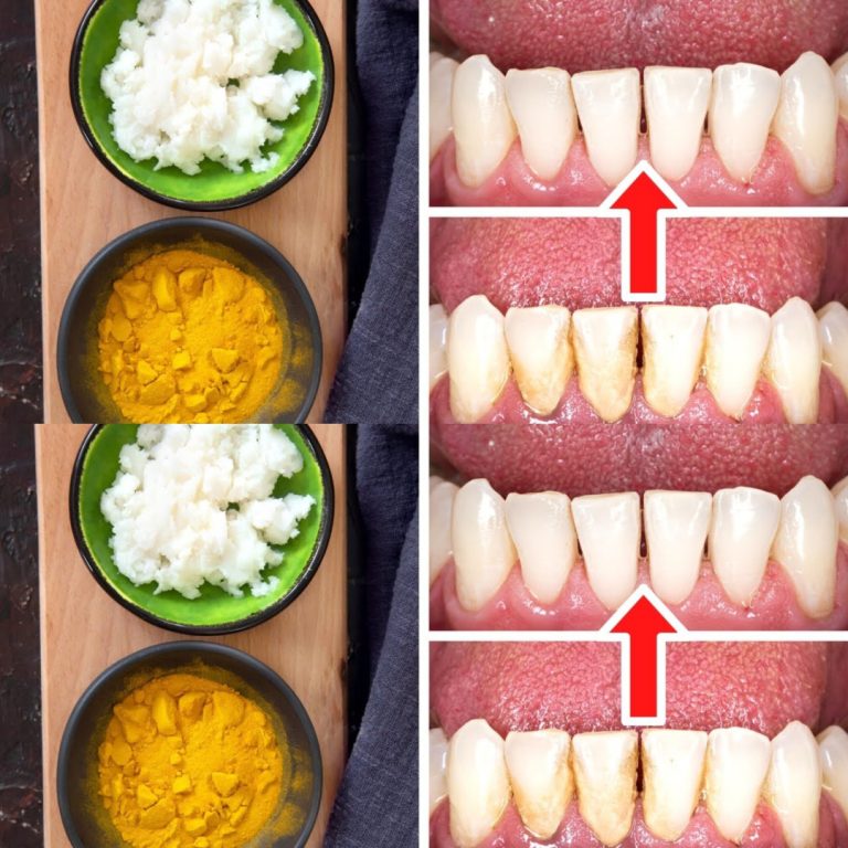 Jak usunąć kamień i osad nazębny bez dentysty: kurkuma i sól